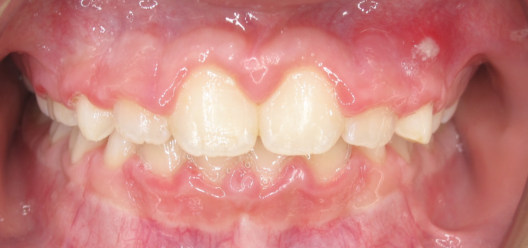 Case #3- Final