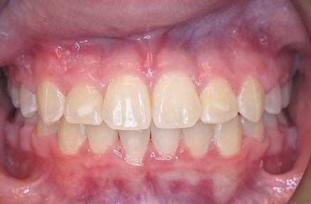 Case #4- Final
