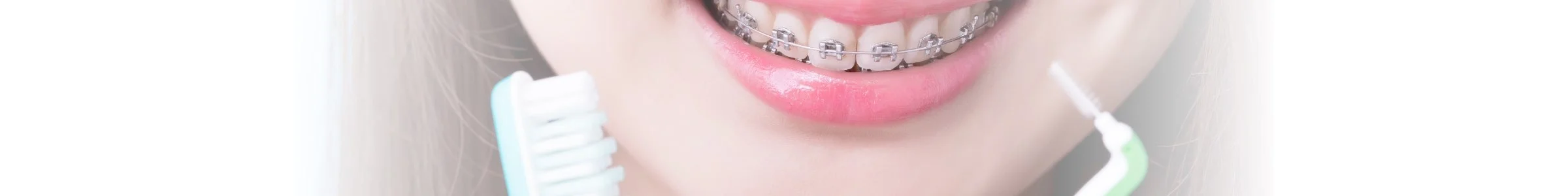 braces-care-guide-1.jpg