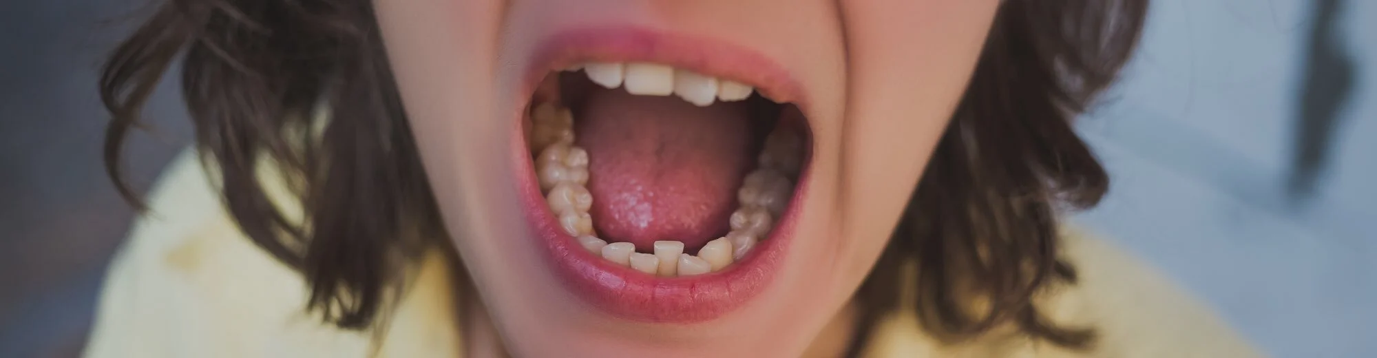 Treating Malocclusion: Common Orthodontic Problems and How to Address Them