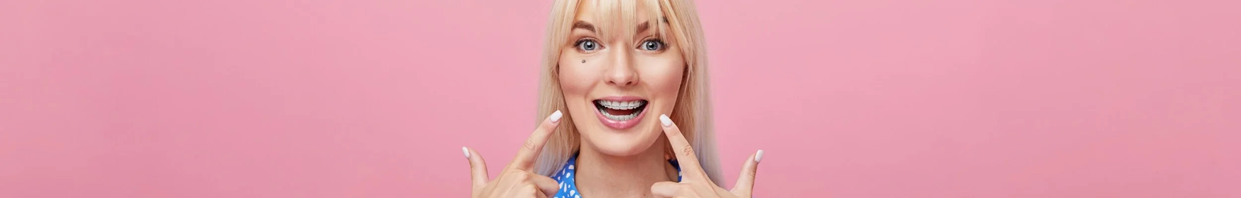 ClearBraces-Header.jpg
