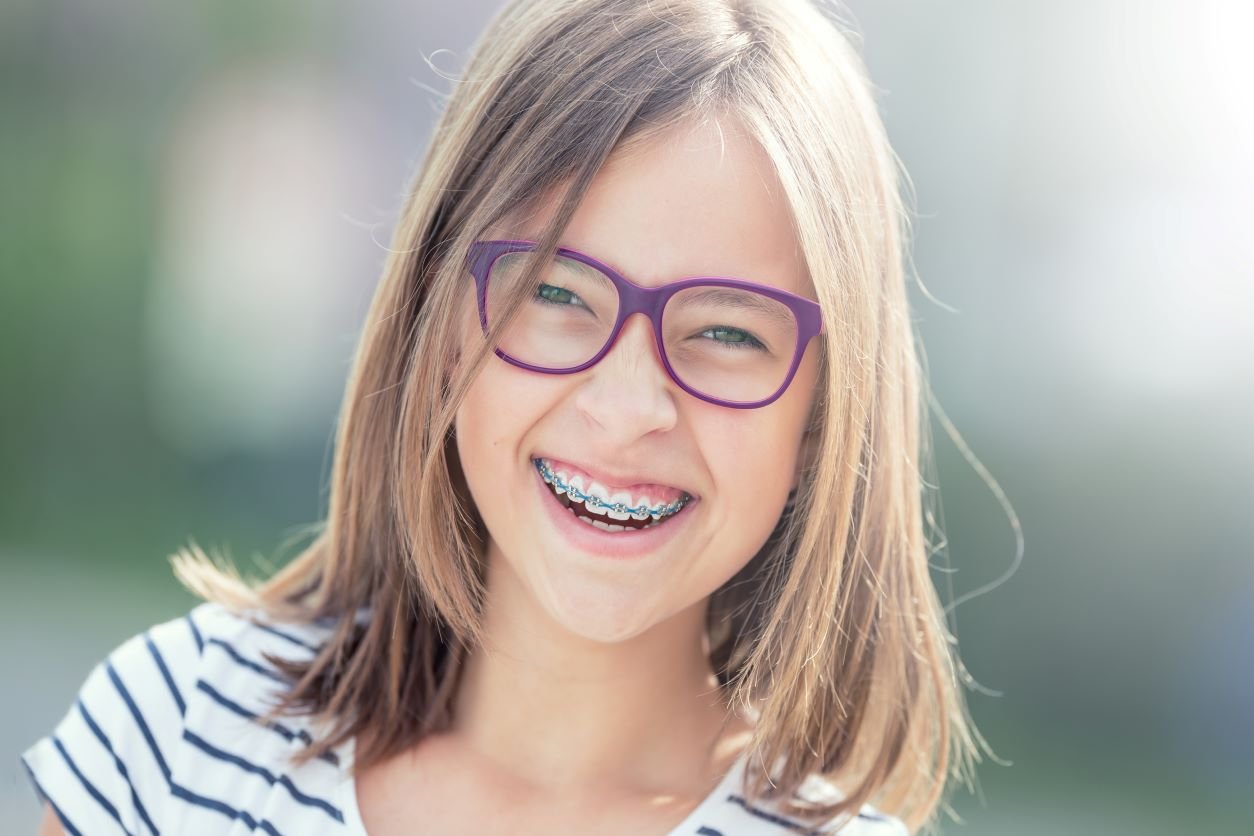 When Should Kids Get Braces and What are the Best Braces for Kids?