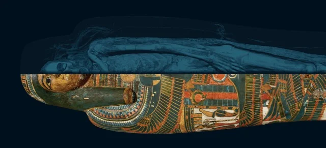 Temple Singer with scan - Trustees of the British Museum