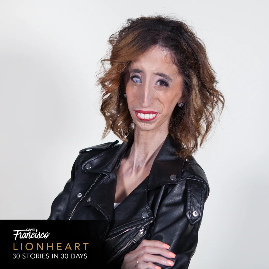 Day 14 - Lizzie Velasquez