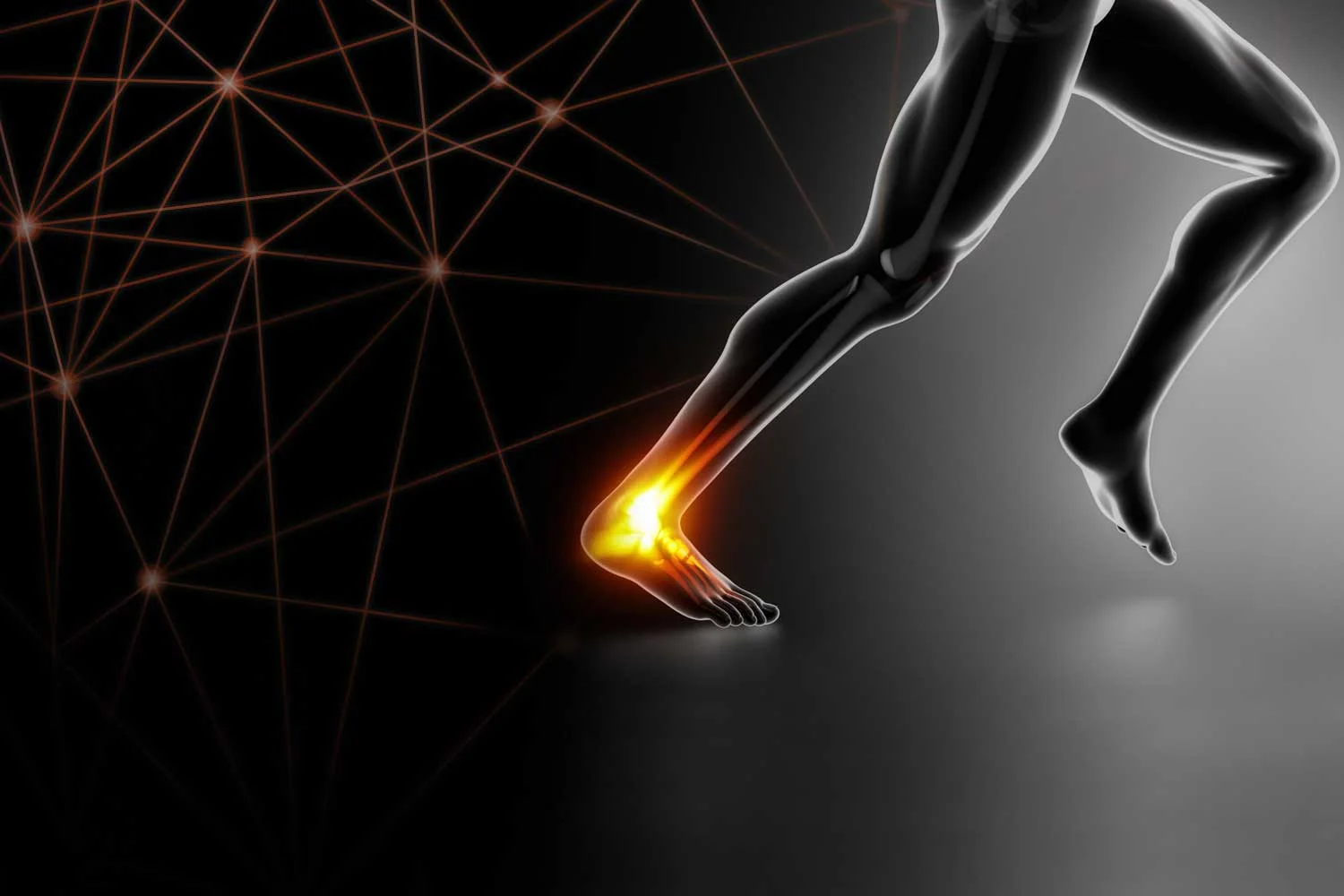 The Costs of Ankle Injuries—and How to fight Them