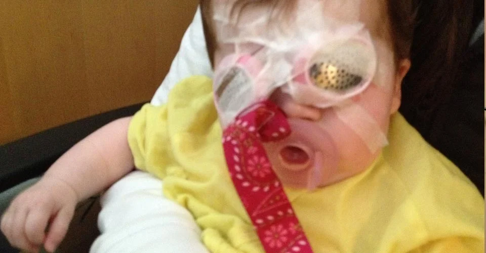 Surgery is scary, but it's probably the best gift a child with sight impairment can be given.