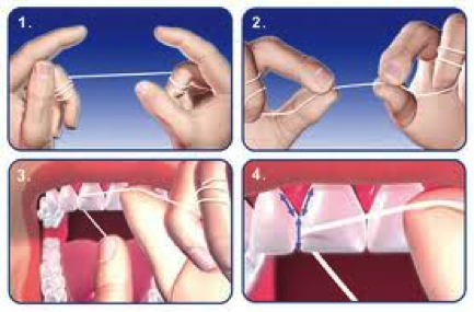 this illustrates the best way to floss.