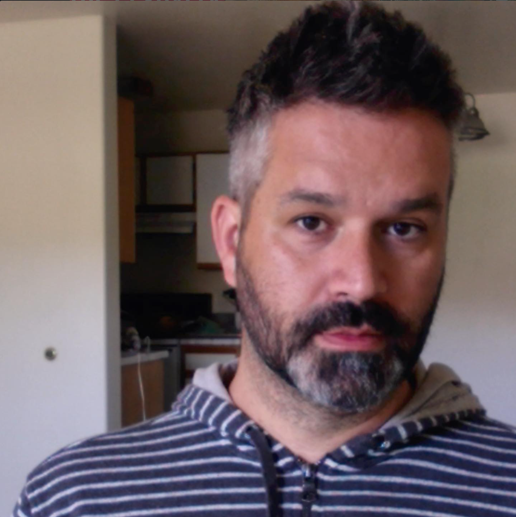 Hair Loss Revisited