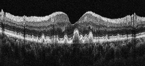 May is Macula Awareness Month! — Carlton Optometrist | Eyetech Optometrists
