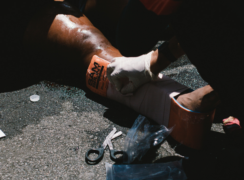 A woman's leg is placed in a splint after she was struck by a car that drove into a crowd of counter-protesters in Charlottesville. (Seth Herald / The Atlantic)