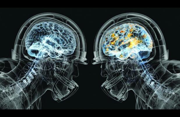 concussion.xray_.P.9-3-15.jpg