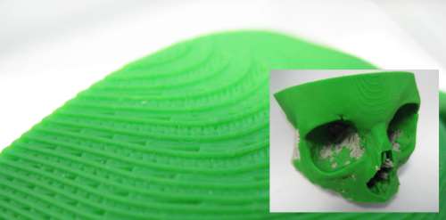 Fused Deposition Modeling - Surgical Planning Tool