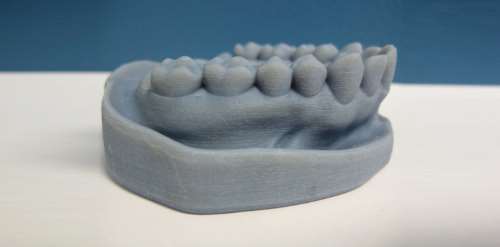 Polyjet 3D Printing - Dental Application