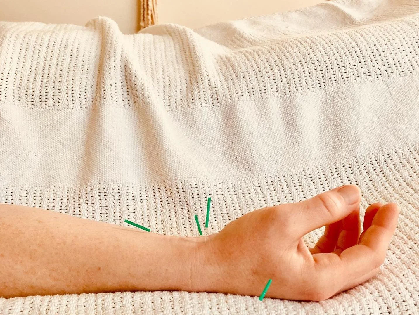 Community Acupuncture Clinic With Tova Steiner, LAc 