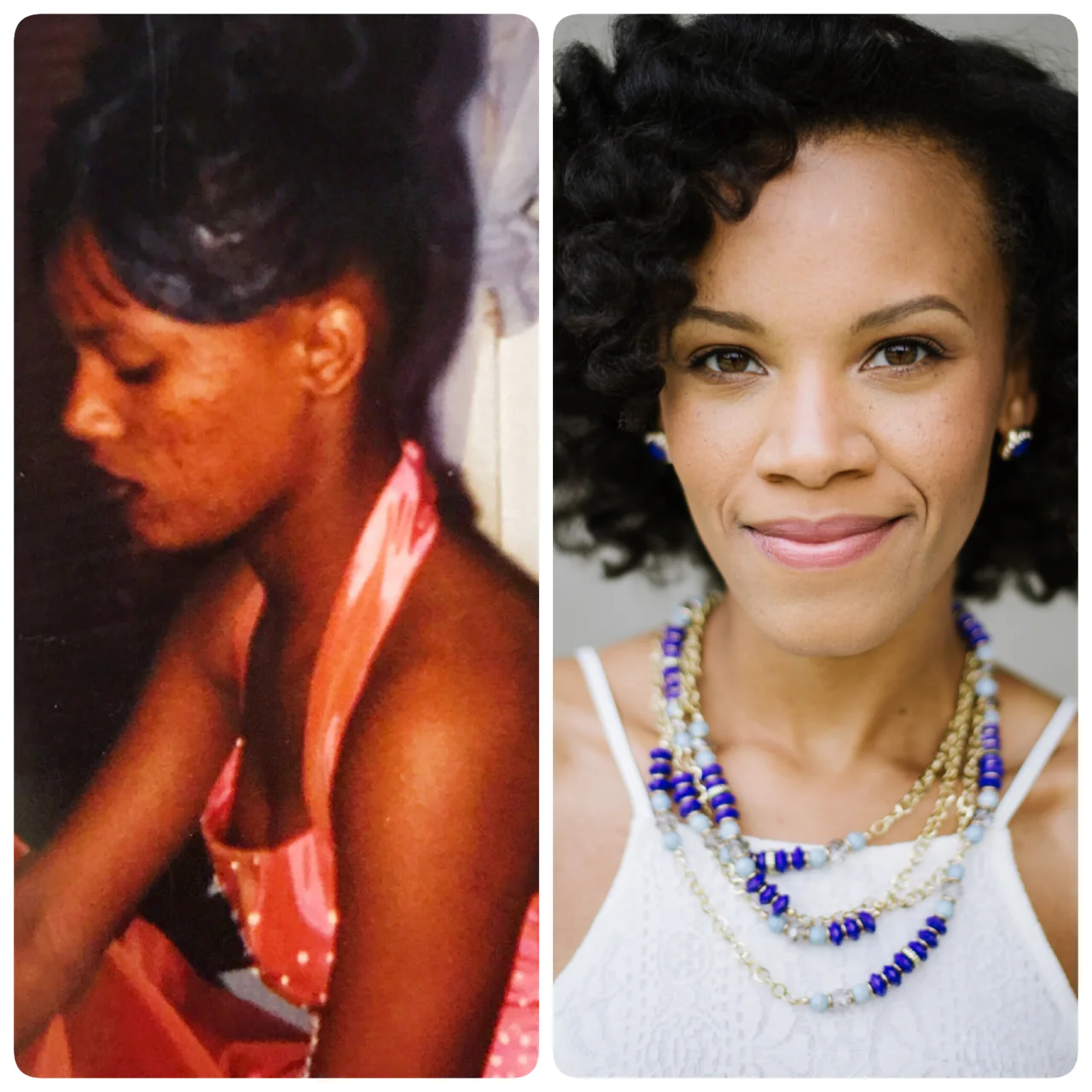 Acne to Clear Glowing Skin