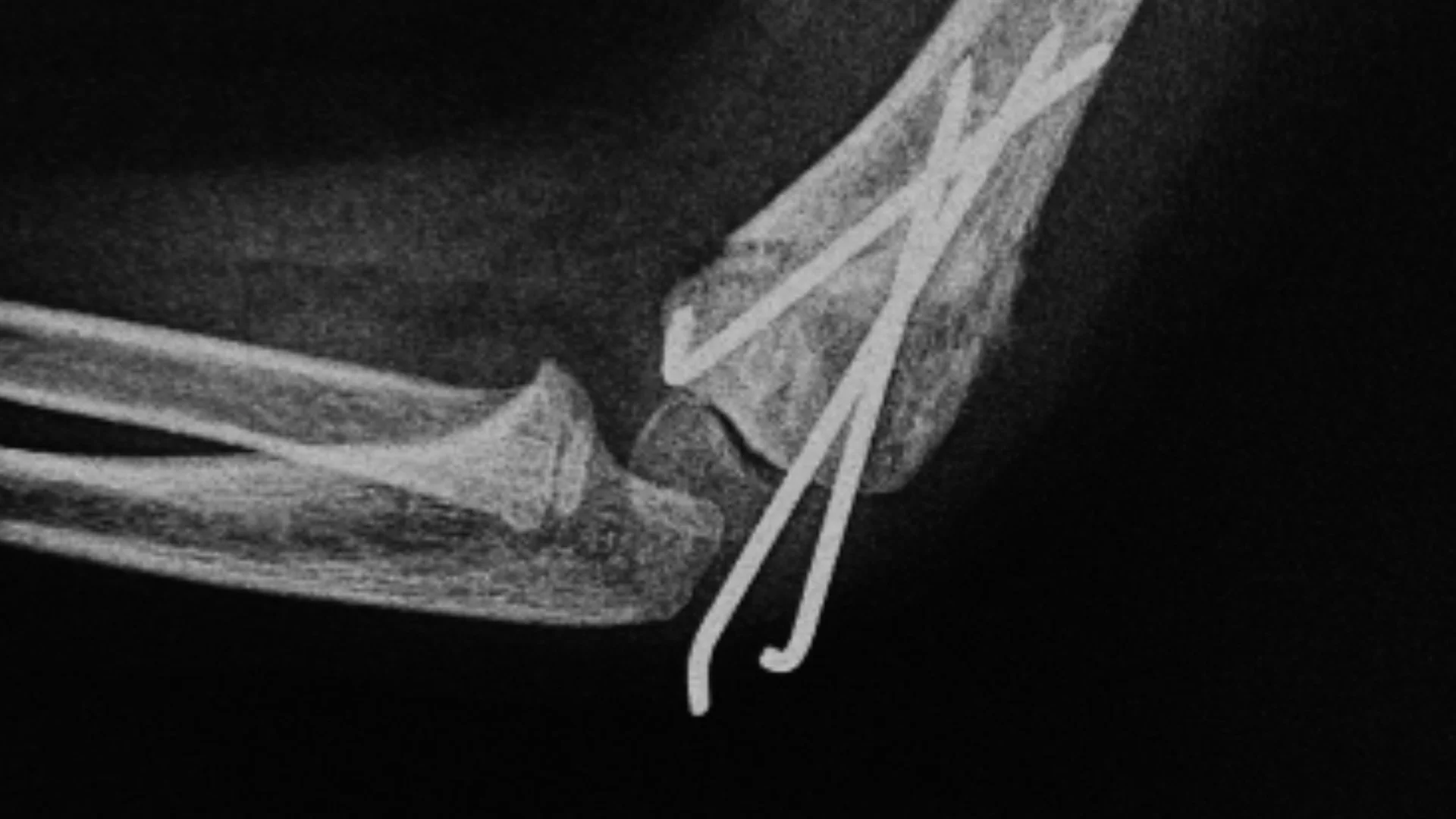 F26_JW Keep Everything_30_16x9_OPENMKT_Master_Generic.mov.01_00_15_15.Still016.jpg