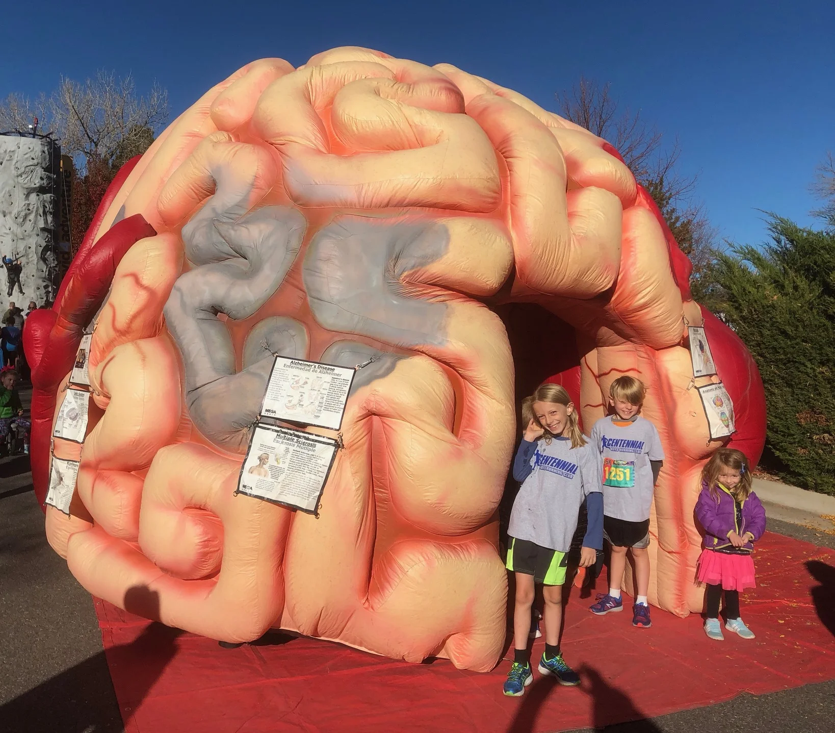 Local children wait outside father's brain.