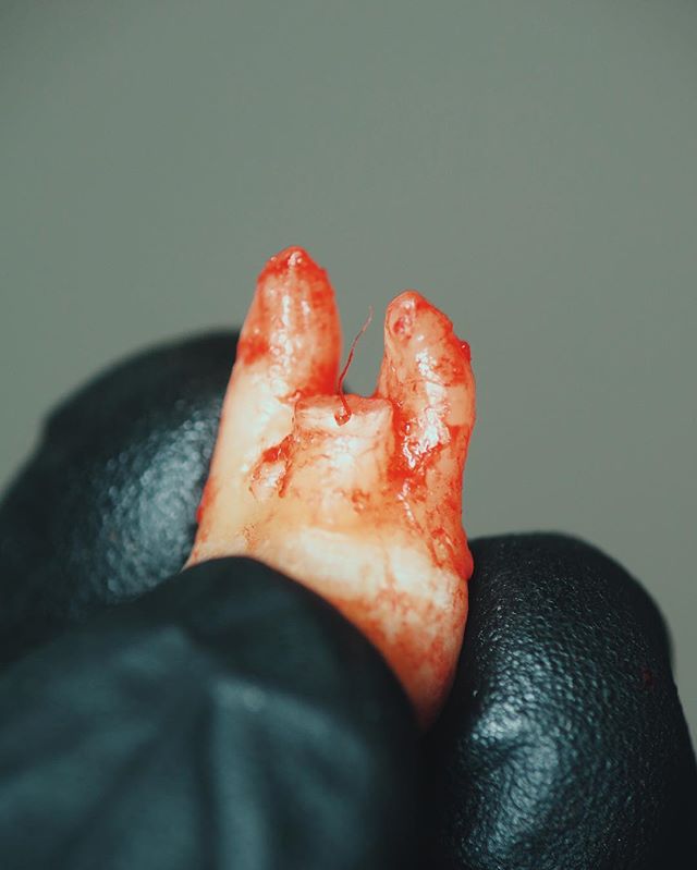 Mondays get on my nerve, amirite? 🦷
