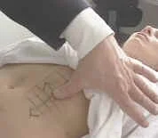 zGastric-point.jpg