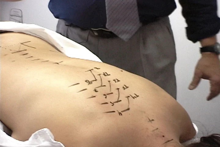 marked thoracic spine.jpg