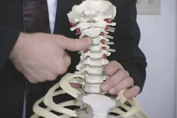 zSkeleton anterior cervical.JPG
