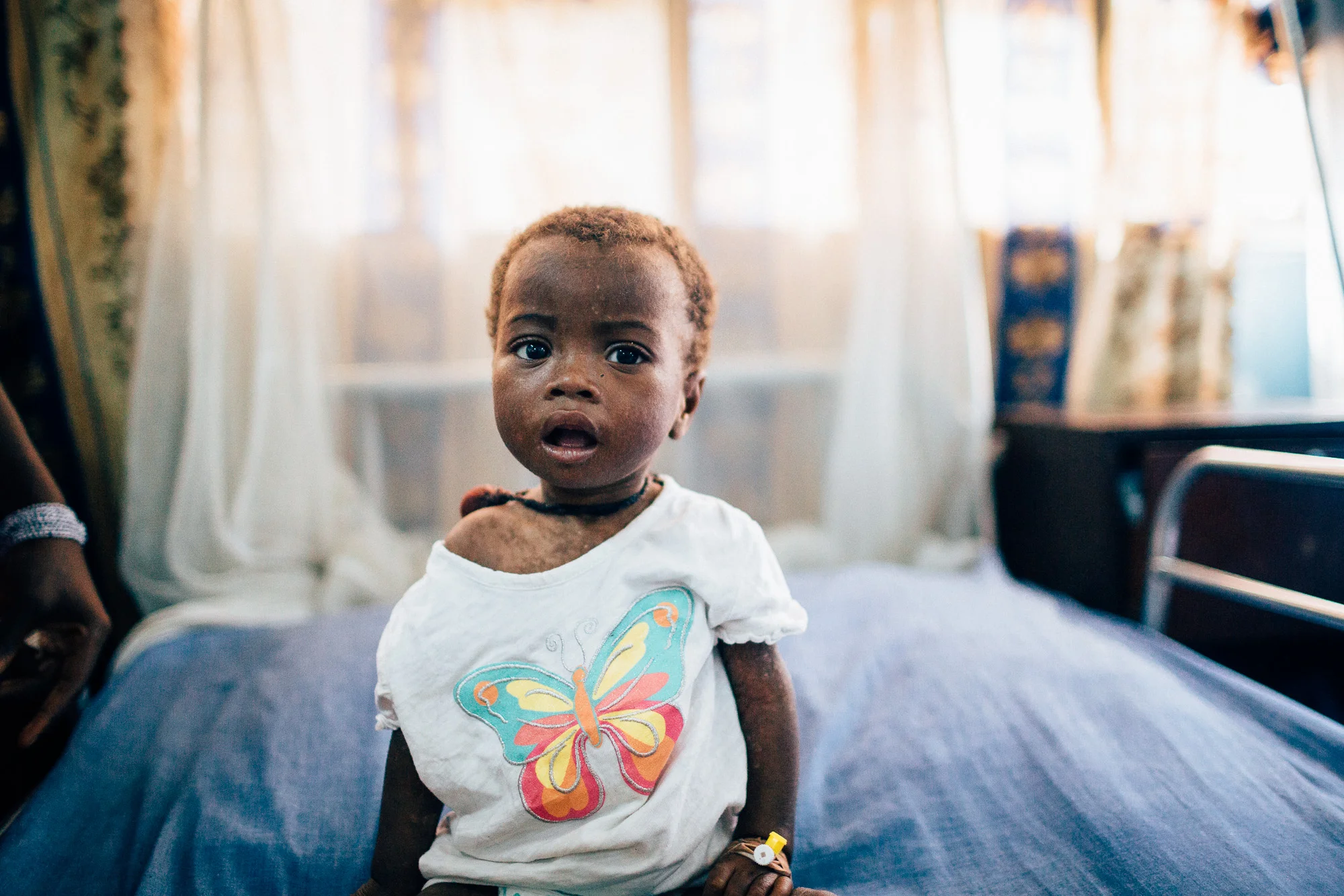 Isatas Sesay is fortunate enough to be on a bed with a Mosquito Net, which is a primary preventative measure against the spread of malaria. OLA During Childrens Hospital, GAVI Alliance. Comic Relief has funded GAVI since 2012 and awared funds in 2014 to purchace and deliver three lifesaving Vaccines to hundres of thousands of children in a selected number of African countries. Immunisation is one of the most effective ways of preventing children from dying from diseses. In africa alone, 600,000 children each year could be saved in vacccine programmes were fully implemened. Most countries have now introduced immunisation programmes in their national health plans, but almost a quater of african children are stil not being vaccinated adequately.