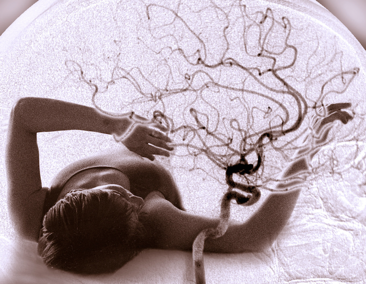 INTERVIEW: Steve Smart on his Work Featured In SciArt's "EmBodied" Exhibit