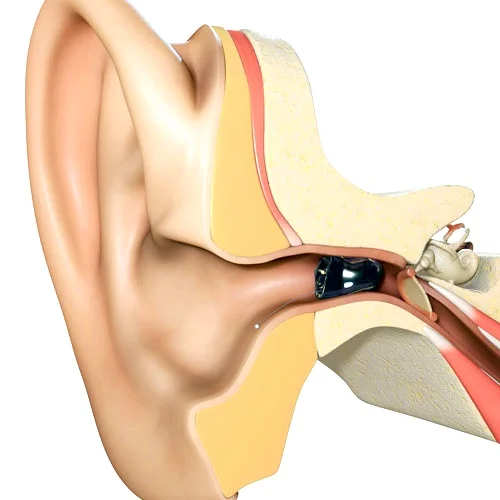 invisible-in-the-canal-shown-in-ear.jpg