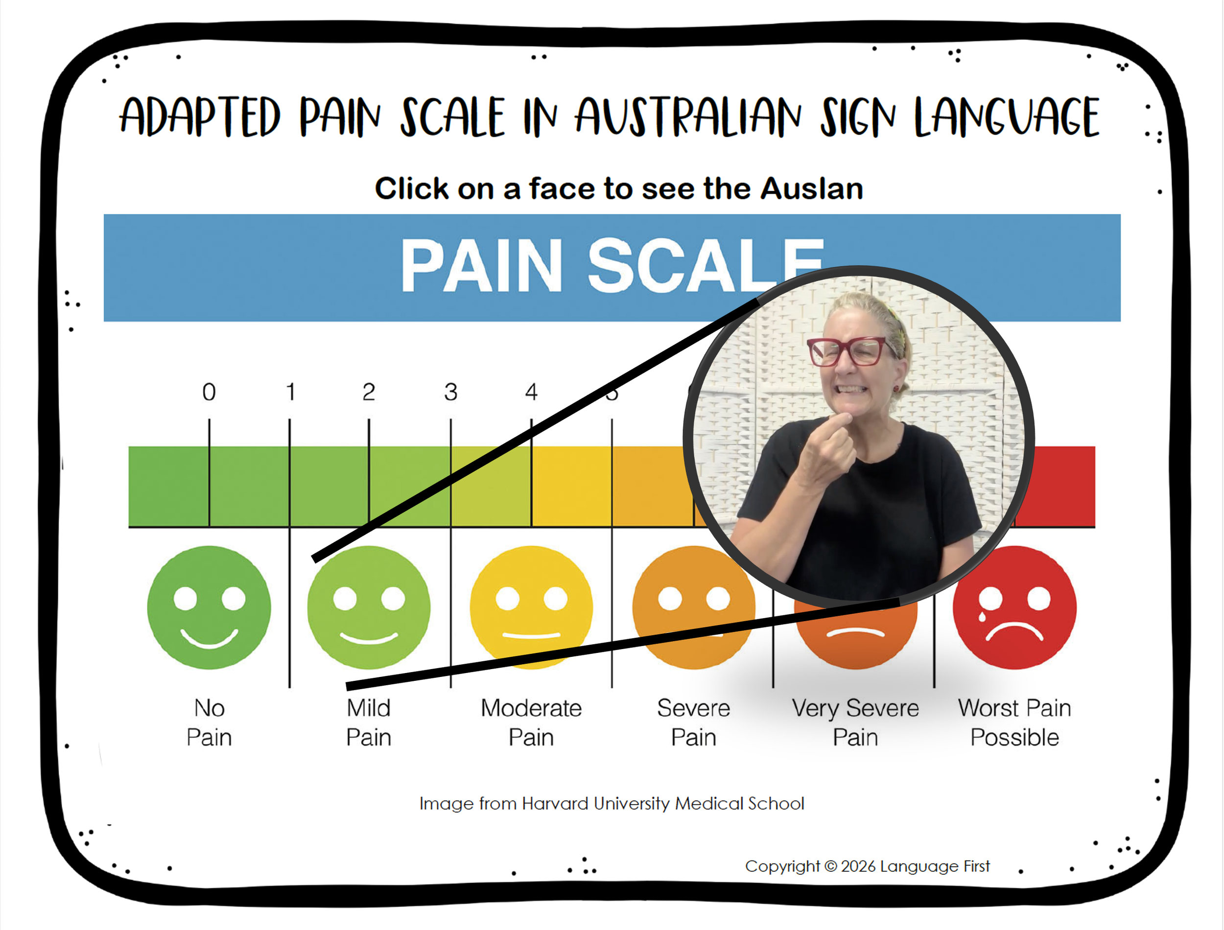 Adapted Pain Scale