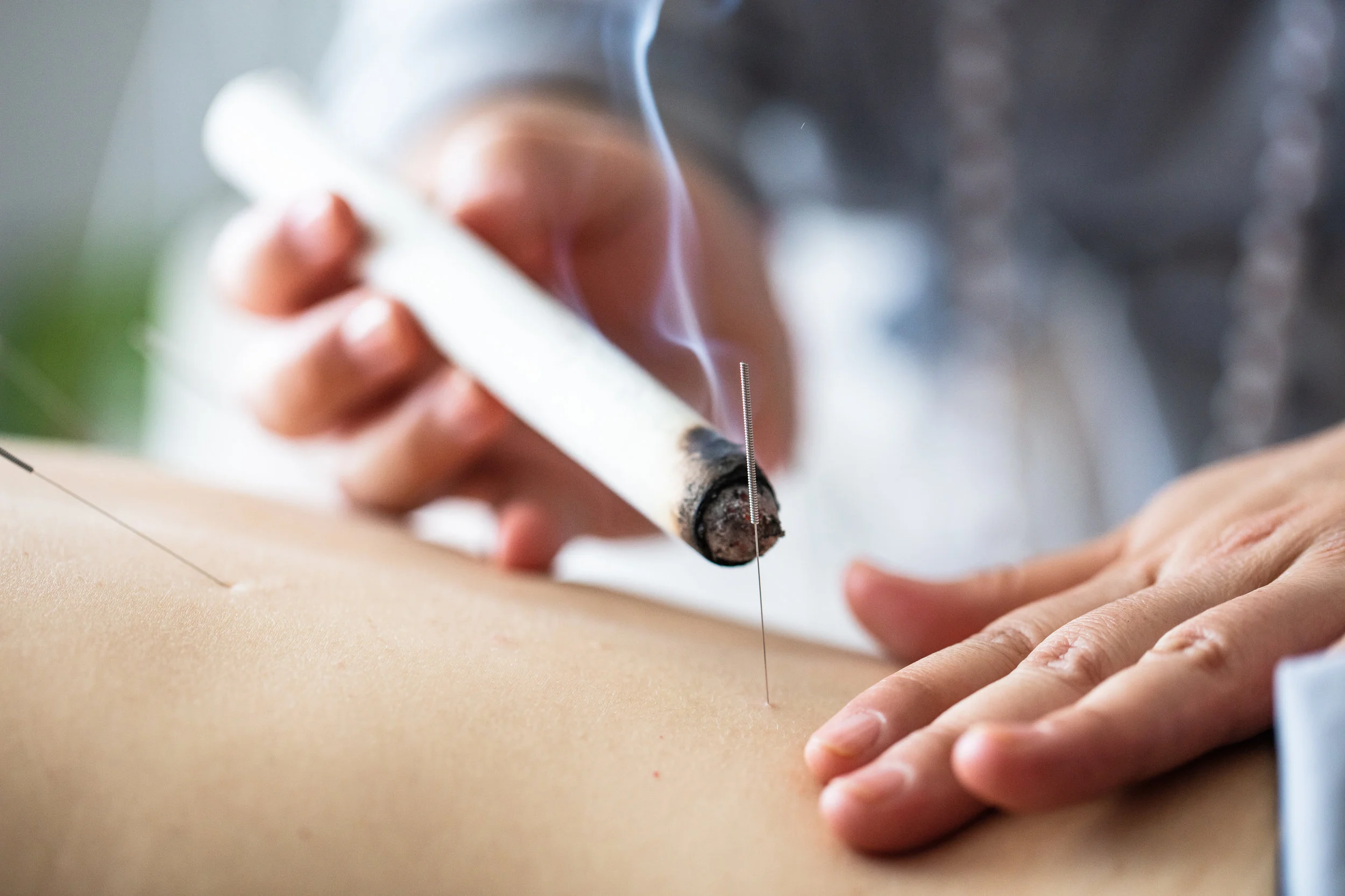 TruingAcupuncture-7422.jpg