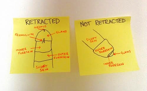 Penis diagrams I just drew especially for you.