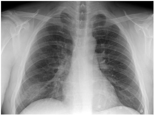 Radiologists beware: algorithms are coming for your job