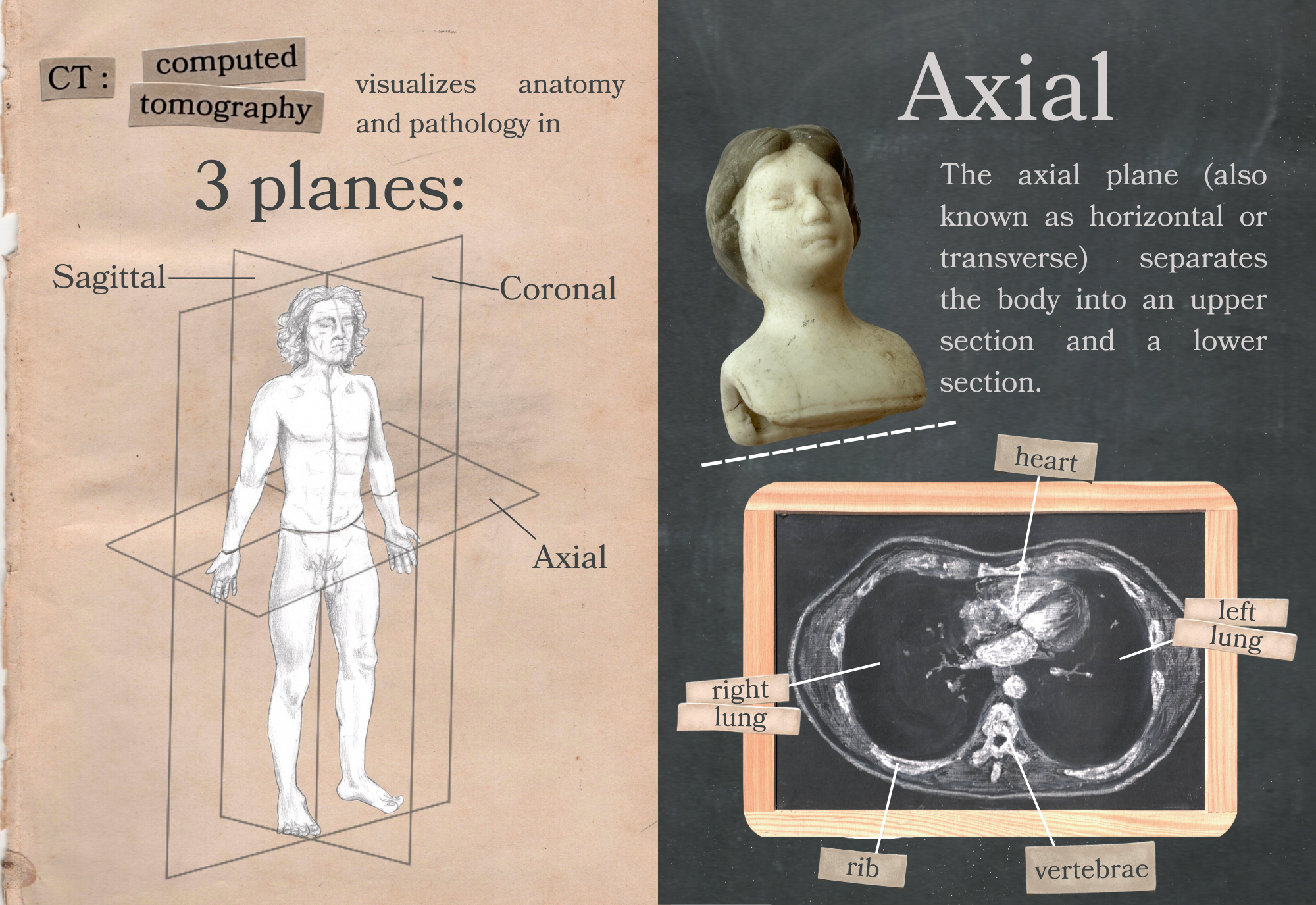 Axial, coronal, sagittal, 2023