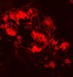 Fluorescence microscopy: Human retinal ganglion cells at day 50. - Courtesy of Johns Hopkins Medicine, Image provided by Valentin Sluch