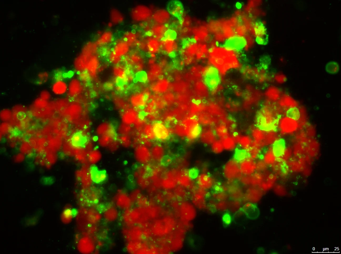 Colon cancer cells. The ones in red are unharmed. The ones in green are undergoing a highly orchestrated form of cellular death called "apoptosis." A new study investigates the role that lipids play in this dying process. - Image Credit: Virginia del Solar