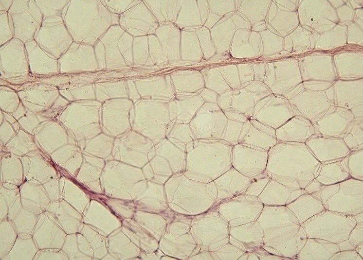 Fat cells in the human body. - Image Credit: WikimediaCommons