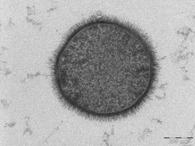 Though fellow: Bacillus subtilis - Image Credit: Allonweiner/wikimedia