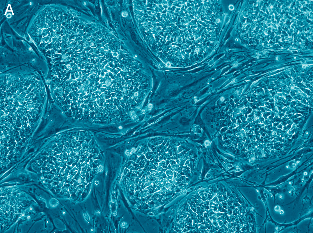 Stem cells: life’s building blocks - Image Credit: Nissim Benvenisty/Wikimedia/Commons
