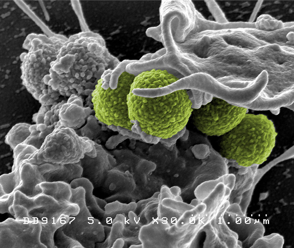 The superbug MRSA (green) interacts with a human white cell. - Image Credit: NIAID/Flickr , CC BY-ND