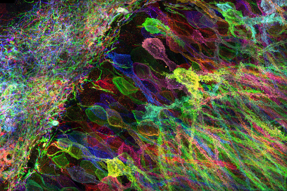 MIT researchers have developed a new way to image proteins and RNA inside neurons of intact brain tissue. – Image Credit: Yosuke Bando, Fei Chen, Dawen Cai, Ed Boyden, and Young Gyu