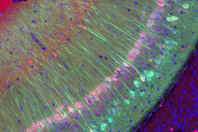 MIT neuroscientists have identified neurons that are responsible for storing memories of familiar individuals. These cells, labeled green, are located in a region of the hippocampus known as the vCA1. - Courtesy of Teruhiro Okuyama