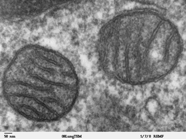 Mitochondria: the part of the cell that generates energy. – Image Credit: Louisa Howard/WikimediaCommons
