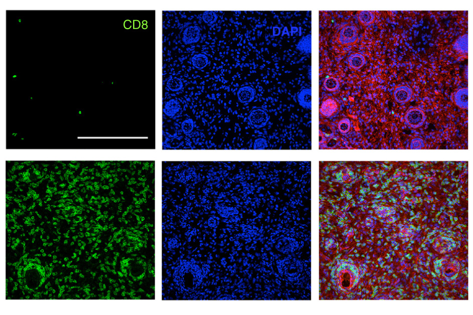 T cells — immune cells that are targeted to find and destroy a particular antigen — are key to the adaptive immune response. In this image, the top row shows few T cells in untreated mice, while the bottom rows show many T cells produced after immunotherapy treatment. - Courtesy of the researchers