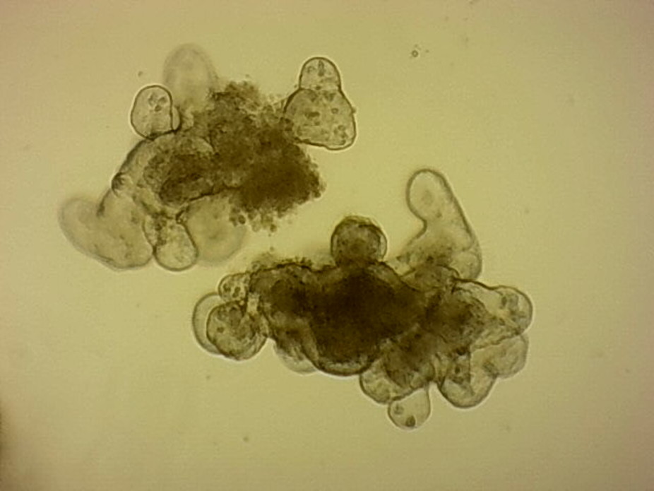 Small intestinal organoids growing in culture. Louise Thompson, Author provided