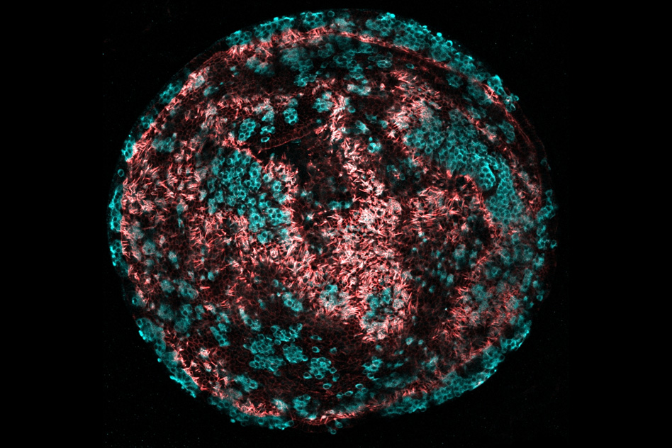 This image shows large clonal colonies of cochlear progenitor cells formed from single cells and converted into high-purity colonies of hair cells (cyan) with intricate hair bundles (red) - Image Credit: Will McLean