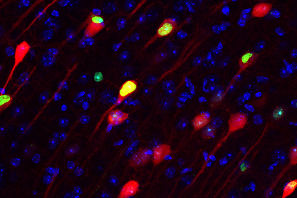 An MIT study of the neural circuits that underlie memory process reveals, for the first time, that memories are formed simultaneously in the hippocampus and the long-term storage location in the brain’s cortex. This image shows memory engram cells (green and red) which are crucial for permanent memory storage in the prefrontal cortex. - Image Credit: Takashi Kitamura