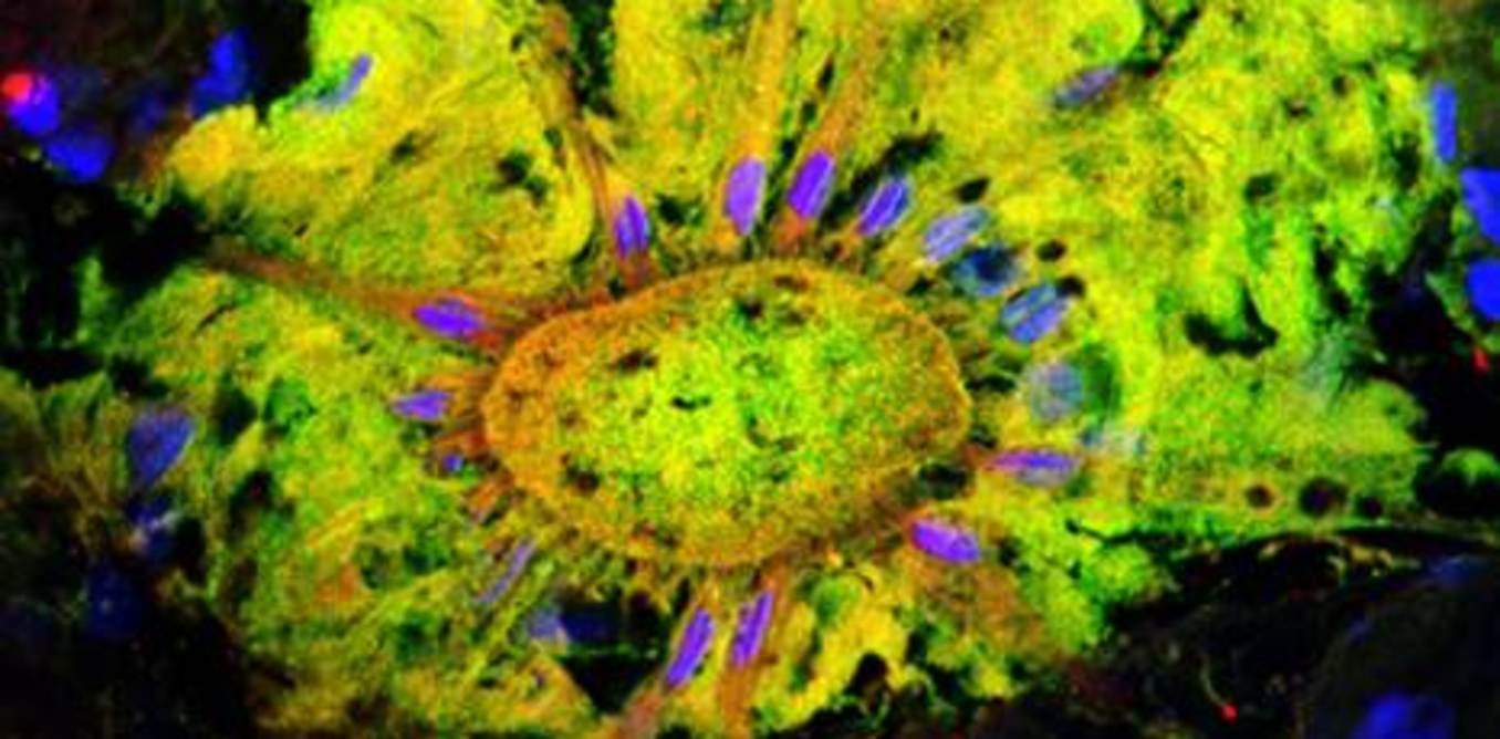Color-changing cells in an Atlantic squid’s skin contain light-sensitive pigments. - Image Credit: Alexandra Kingston, CC BY-ND