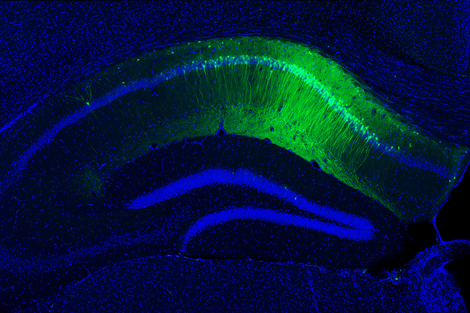 The green staining shows hippocampal CA1 engram cells, which store a long-term fear memory and have the light sensitive optogenetic protein channelrhodopsin-2. The blue staining shows all cells in the dorsal hippocampus brain region, including non-engram cells (blue color staining only). - Image Credit: Dheeraj Roy, Tonegawa Lab/MIT