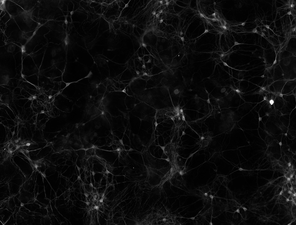 Researchers activated mouse neurons growing in a dish. - Image Credit: Kelsey Tyssowski, CC BY-ND