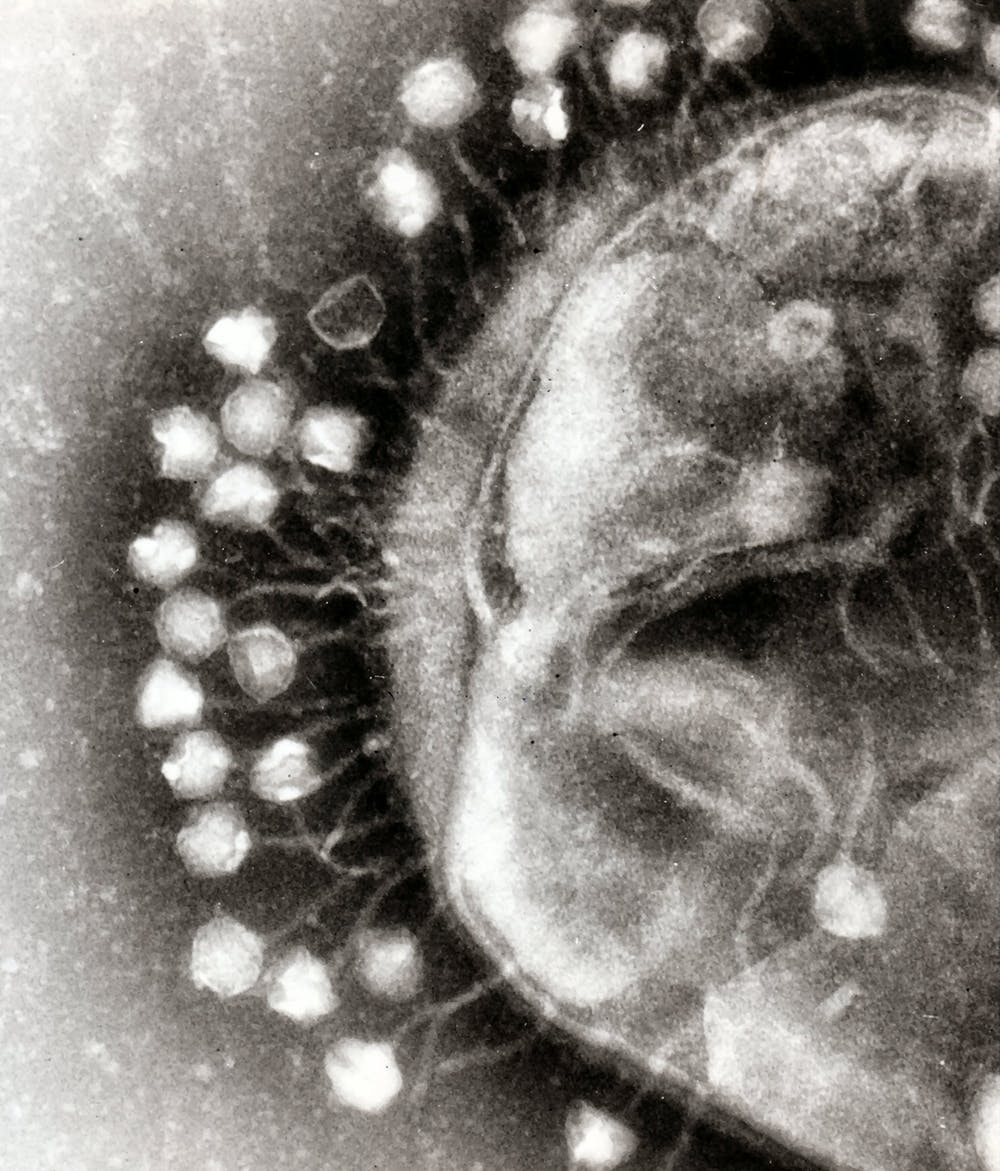 Transmission electron micrograph of multiple bacteriophages attached to a bacterial cell wall. - Image Credit: Dr. Graham Beards , CC BY-SA - (click to enlarge)